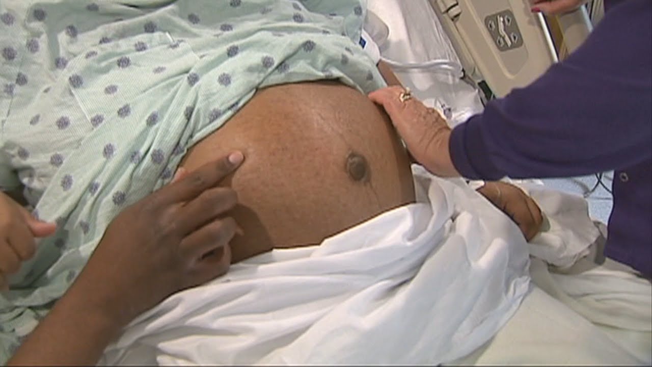 New study shows another hidden danger of the coronavirus in pregnancy
