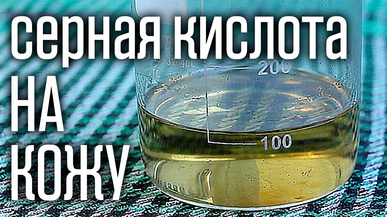 🔥 Что будет если серная кислота попадет на кожу? Первая помощь при ожогах.