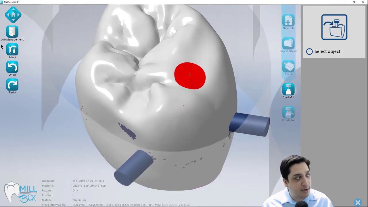MillBox 2019: Hybrid Abutment and Screw Retained Workflow