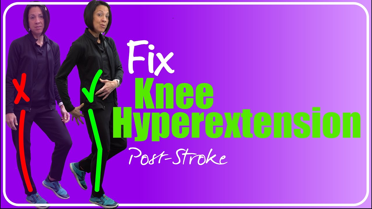 Correct Knee Hyperextension after a Neurologic Injury