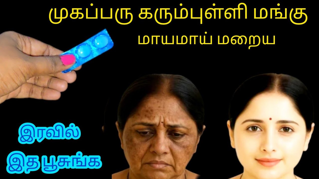 நாட்பட்ட மங்கு மறைய தூங்கும் முன் இத செய்ங்க/Kitchentips/@nalinimanickcooking 