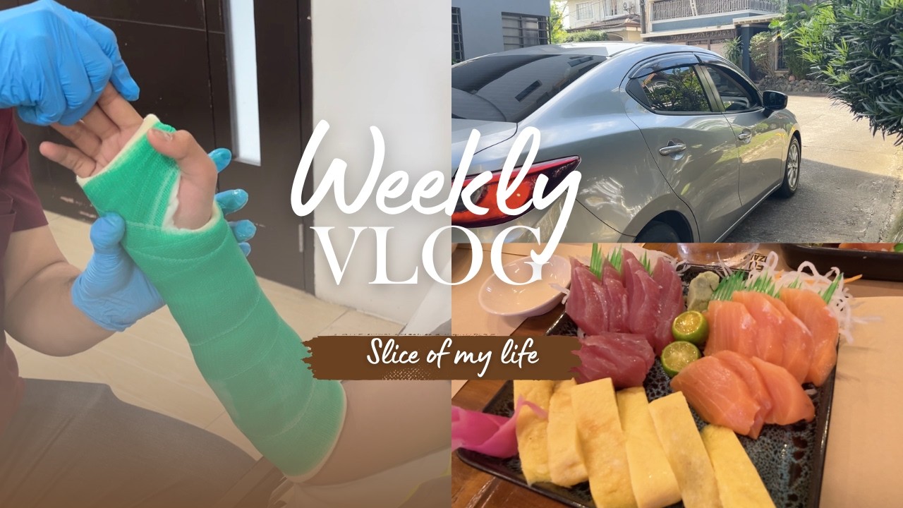 Weekly Vlog: Favorite food | sold car | Wrist Fracture