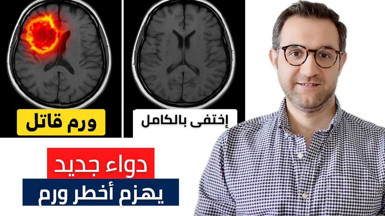السرطان اختفى! دواء جديد يهزم أخطر ورم دماغي في العالم!