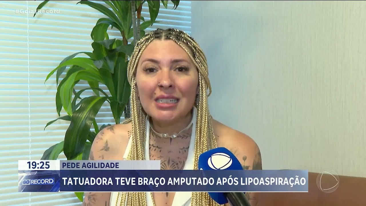 Tatuadora teve bra&ccedil;o amputado ap&oacute;s lipoaspira&ccedil;&atilde;o
