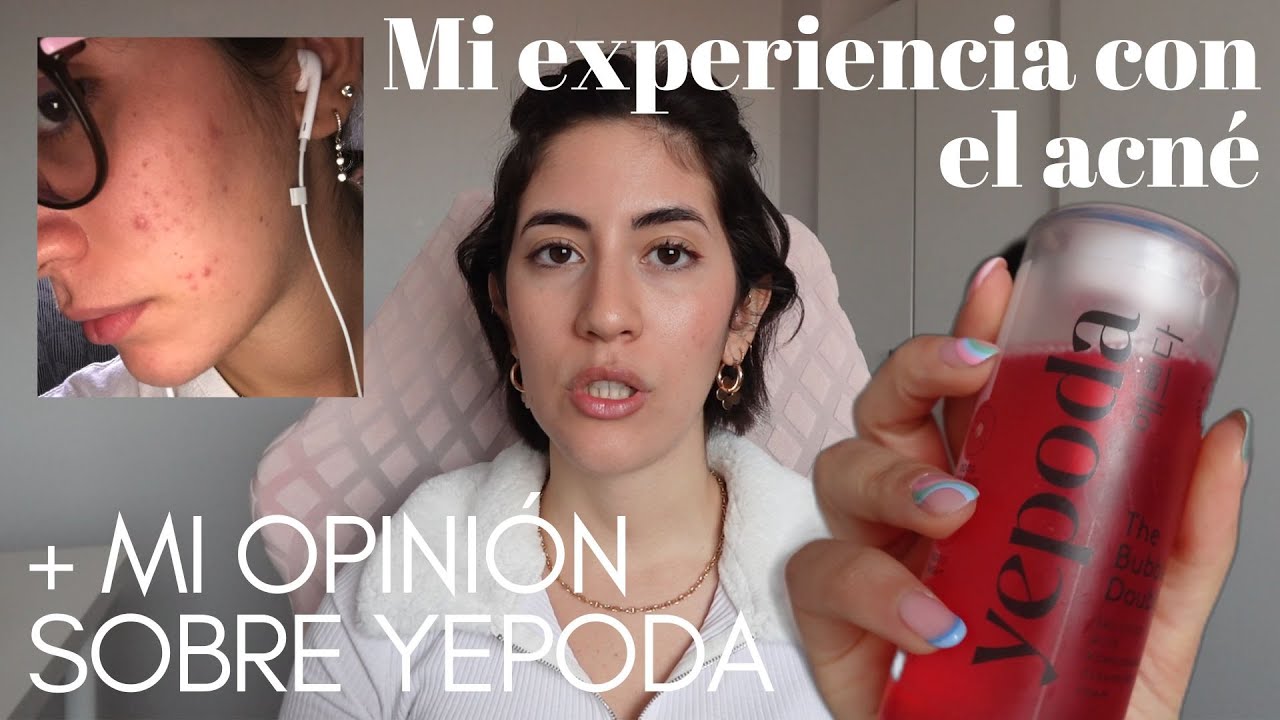 Mi experiencia con acné | Productos de skincare, consejos, recomendaciones, & opinión sobre YEPODA✨