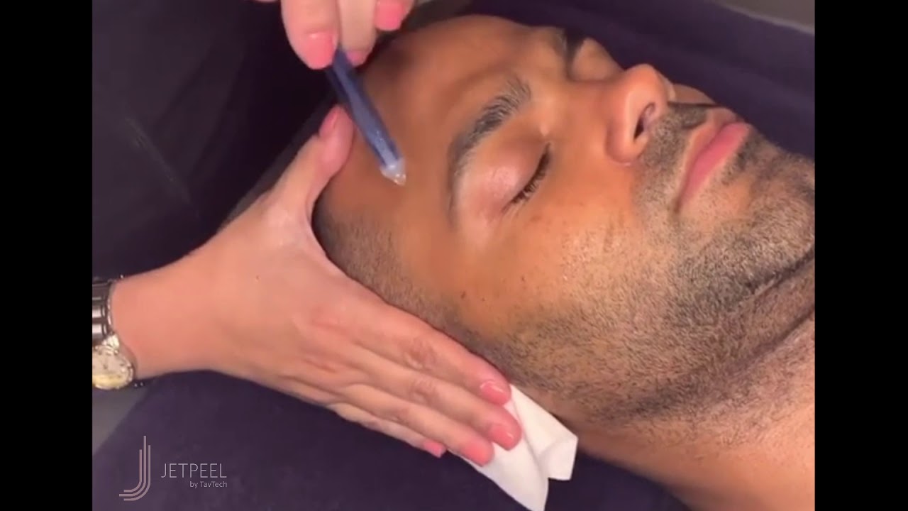 How Does JetPeel Work | JetPeel Facial Treatment