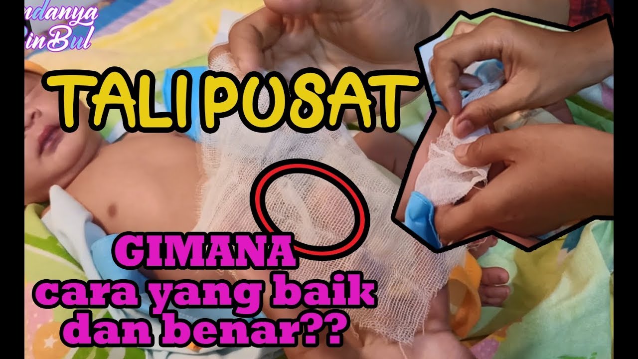CARA MUDAH MELINDUNGI TALI PUSAT BAYI YANG BELUM PUPUT DENGAN...