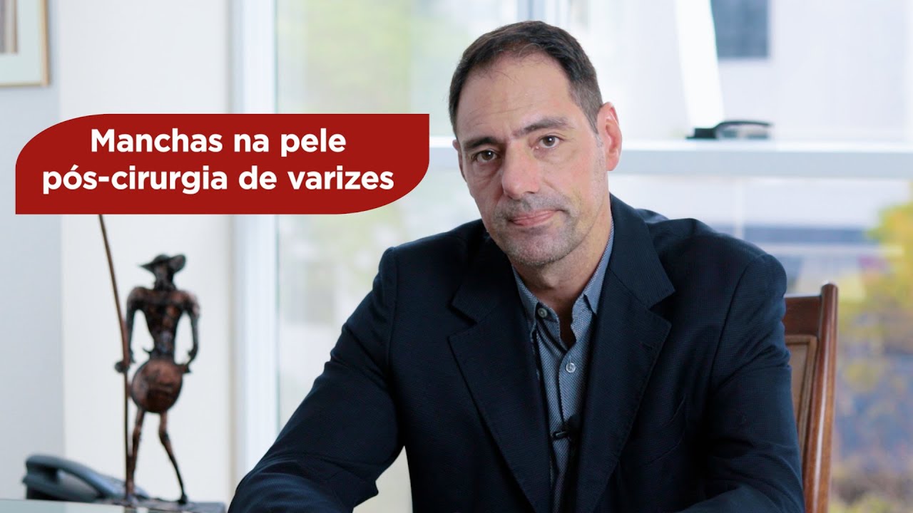 Manchas na pele pós-cirurgia de varizes