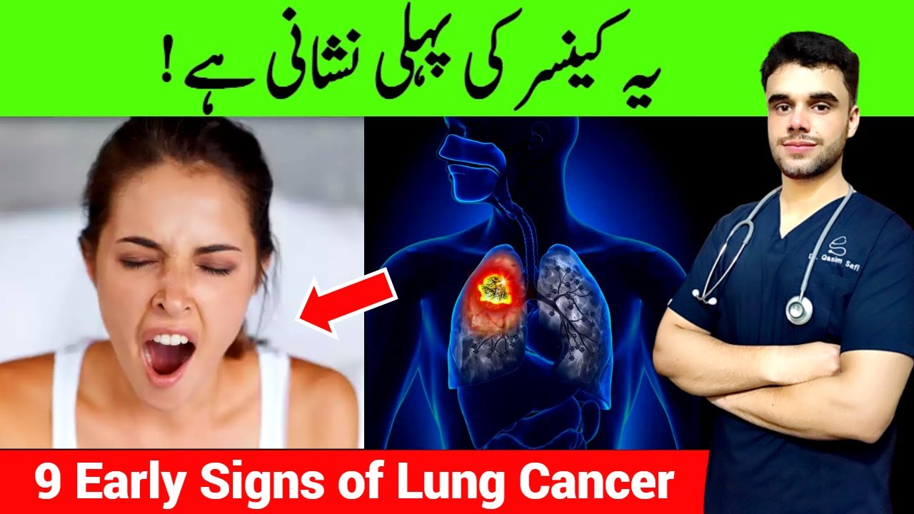 Dr. Cas: 9 Early Warning Signs of Lung Cancer