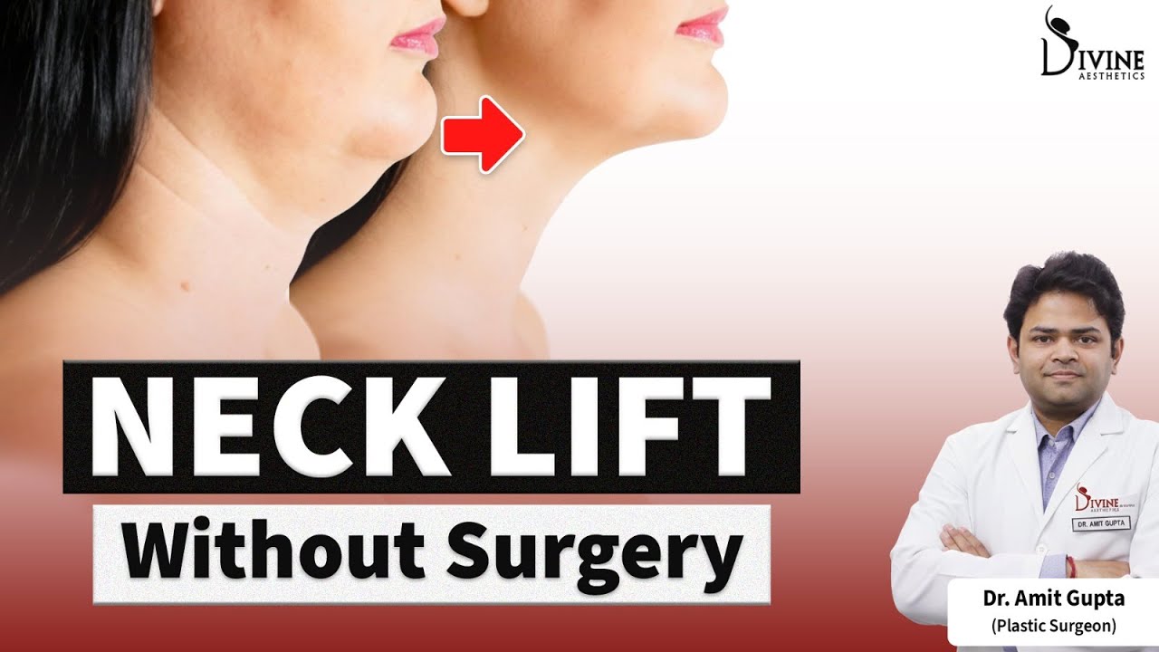 Neck Lift with Permanent Threads Explained | Advanced Neck Tightening | Dr Amit Gupta