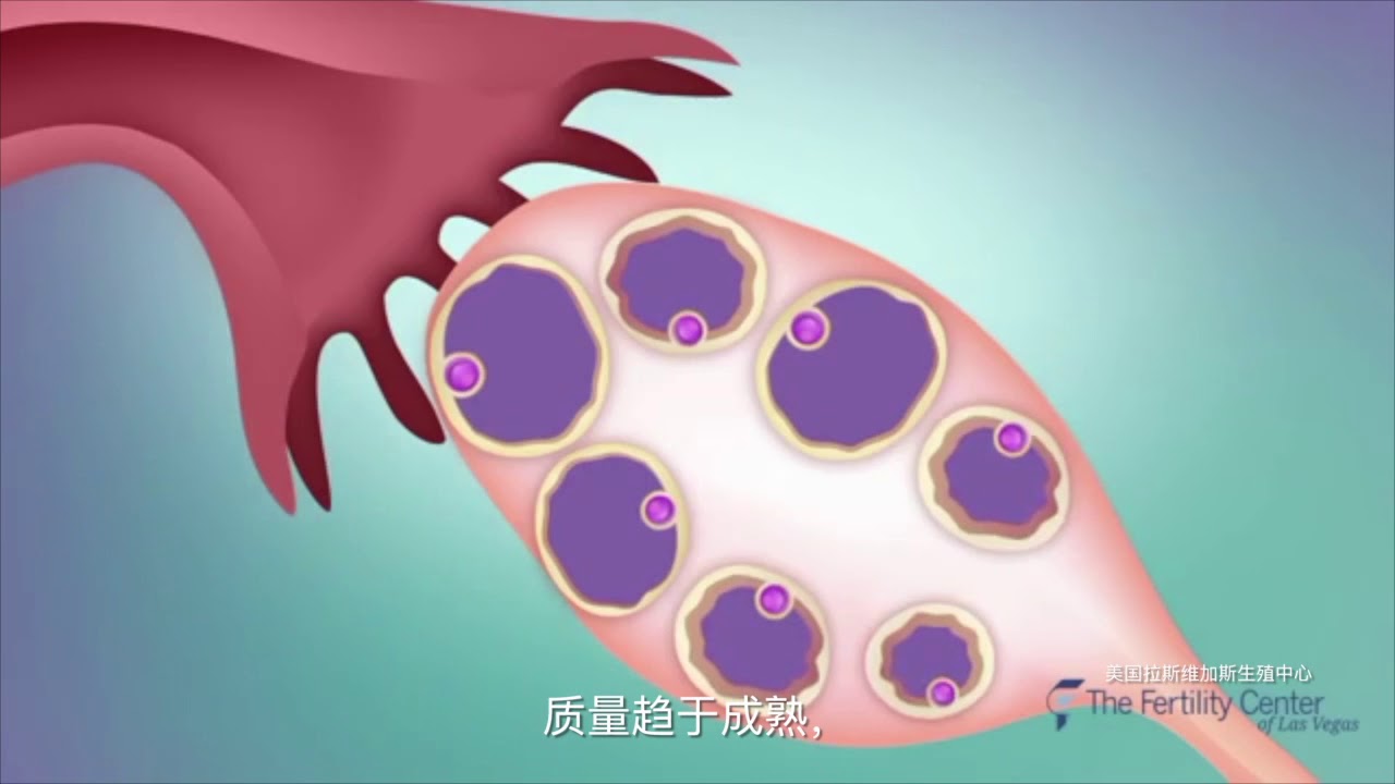 试管婴儿全过程介绍  In Vitro Fertilization Procedure IVF