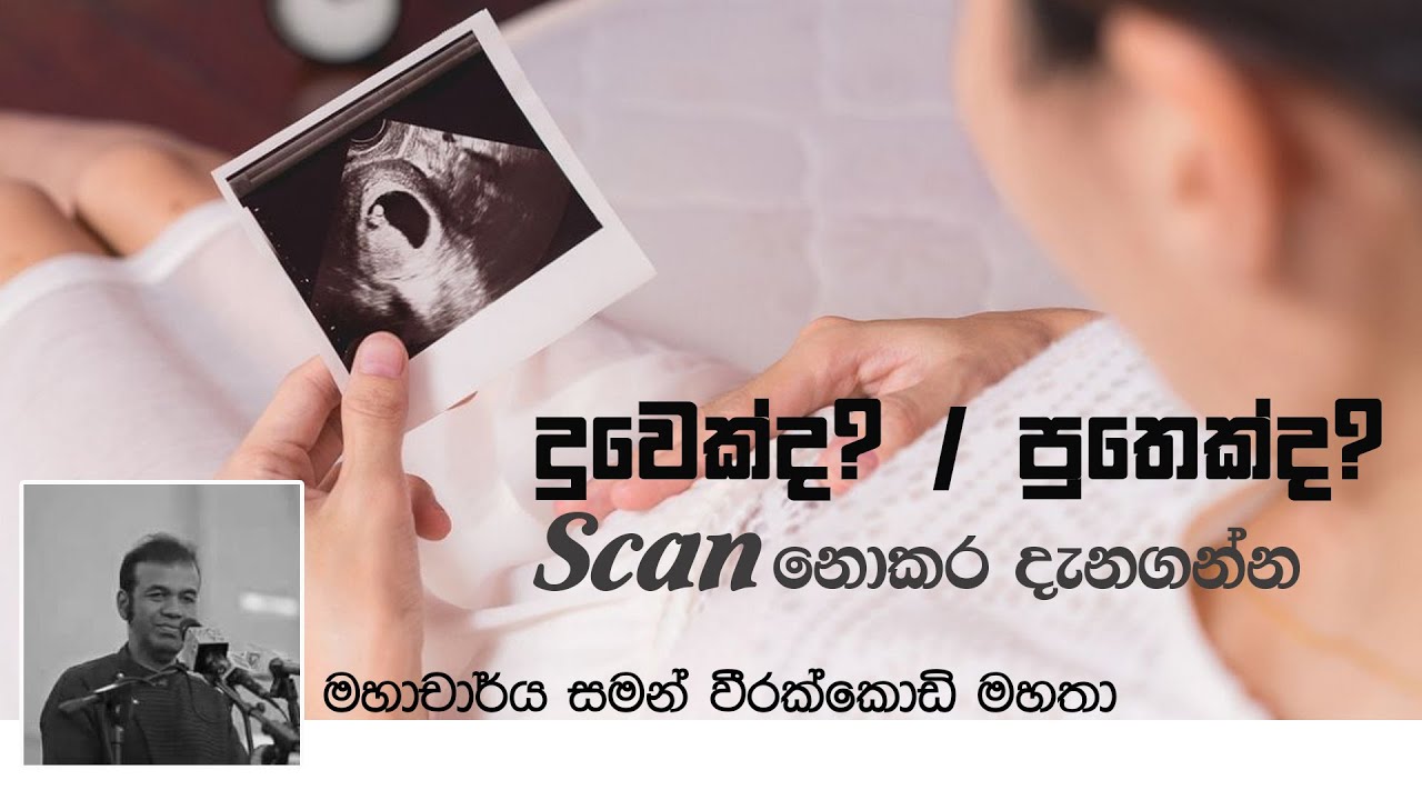 දුවෙක්ද? පුතෙක්ද? - scan නොකර දැනගන්න  | how to guess boy or girl without scan