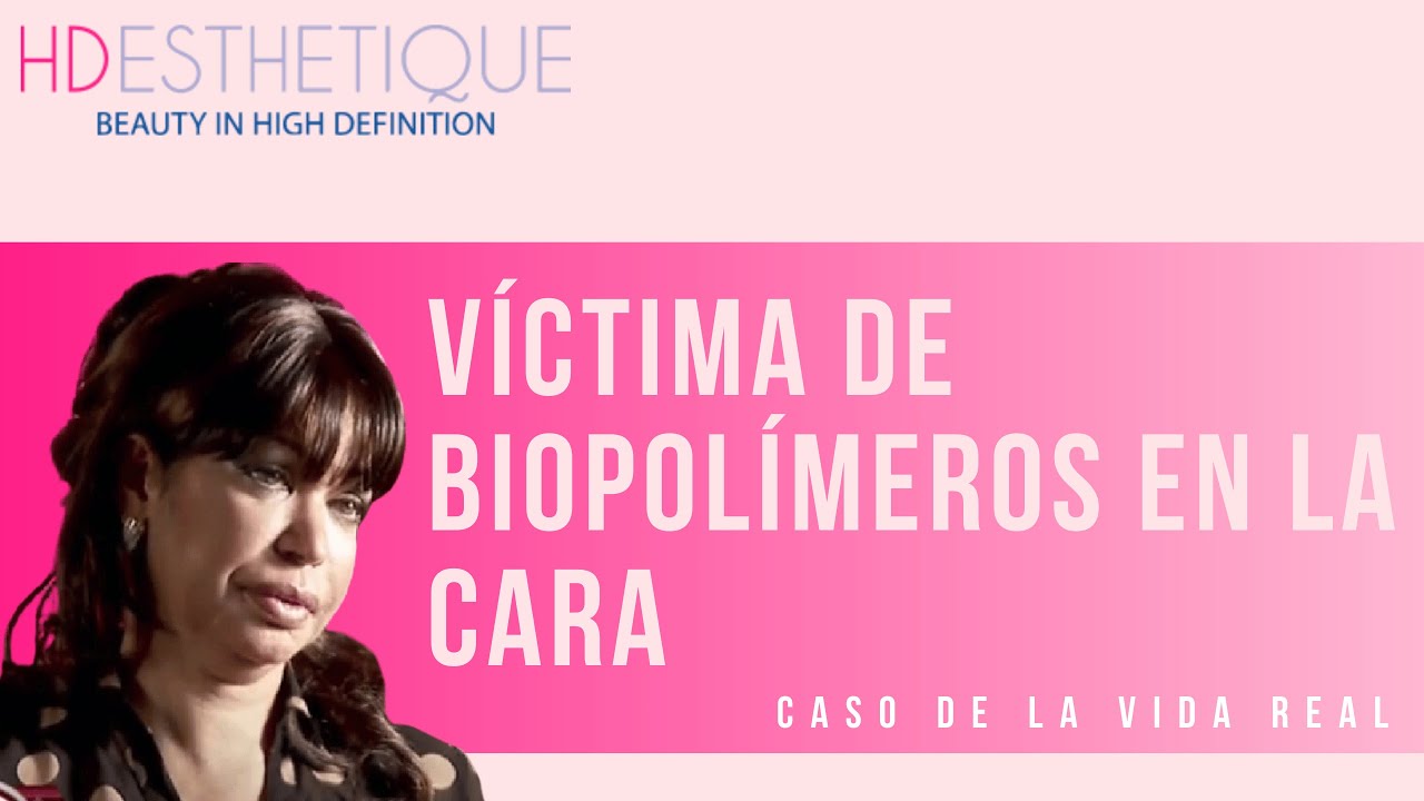Victima de biopolímeros en la cara | Caso de la vida real