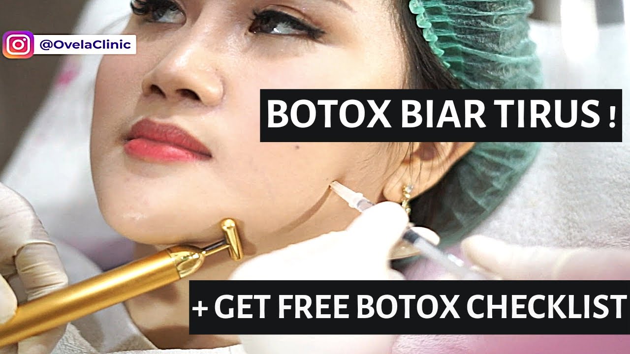 Botox Rahang Before After + REVIEW BOTOX (Lebih Tirus & V-Shape) - Ovela Clinic Jakarta