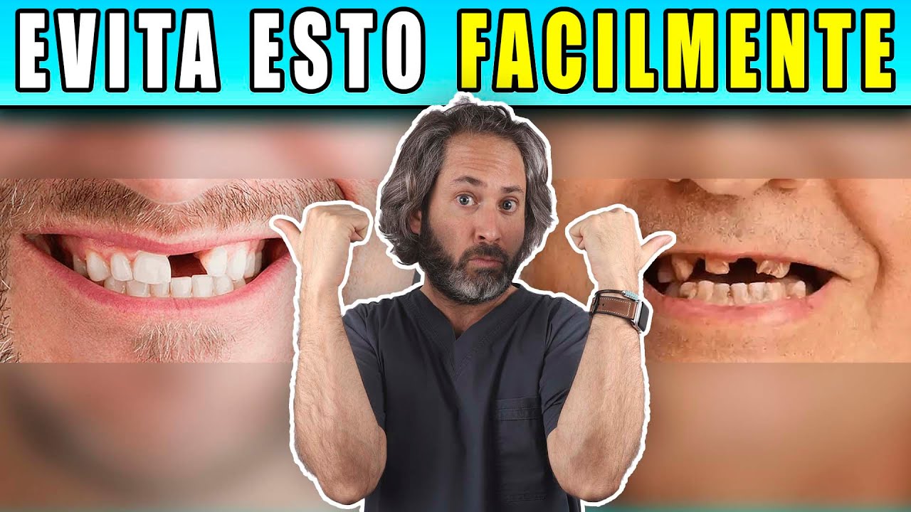 🔴 ¿Porque se me 𝗖𝗔𝗘𝗡 los DIENTES 𝗦𝗢𝗟𝗢𝗦, a 𝐓𝐑𝐎𝐙𝐎𝐒 o EN 𝗣𝗘𝗗𝗔𝗖𝗜𝗧𝗢𝗦? 𝗖𝗟𝗔𝗩𝗘𝗦 para EVITARLO Y SOLUCIONARLO