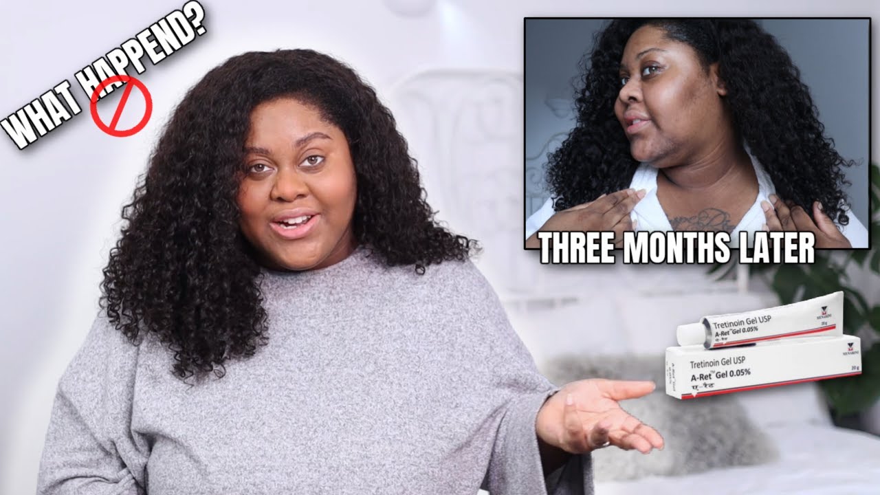 I STOPPED USING TRETINOIN - This is what happened to my skin