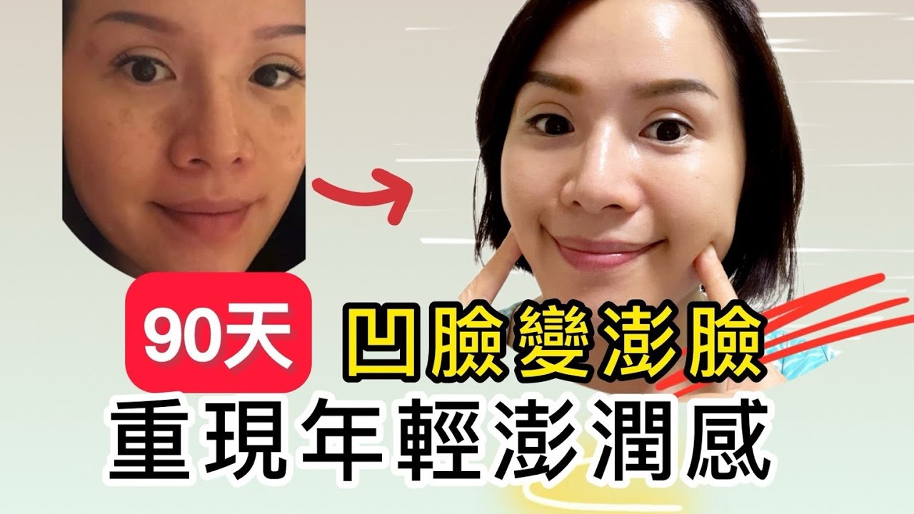 90天凹臉變澎澎臉｜平復老態、衰臉｜