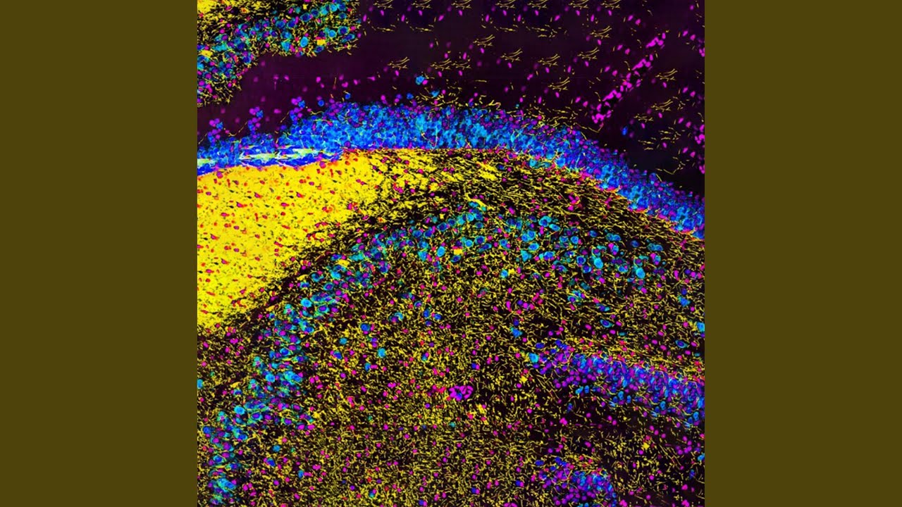 Intelligence artificielle