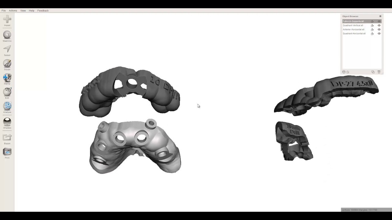 Preparing Surgical Guides for 3D Printing