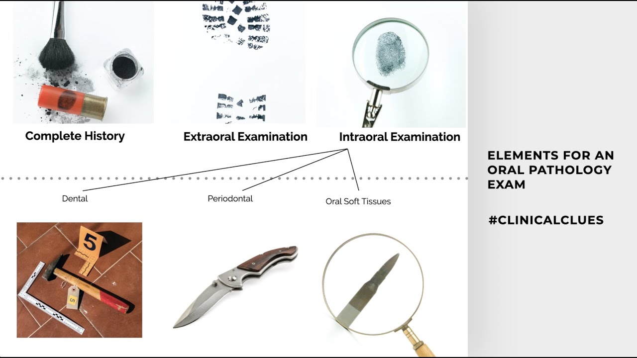 The Art of the Oral Pathology Exam | #clinicalClues for Dental Detectives