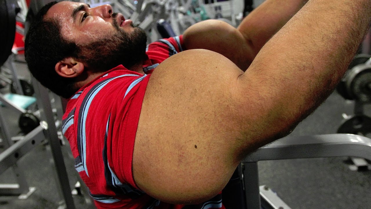 What Is Synthol?