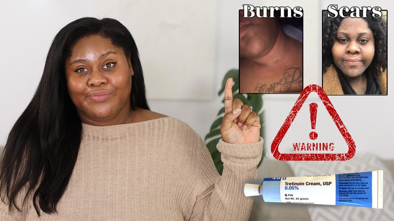⚠️ WATCH THIS BEFORE USING TRETINOIN / RETIN A