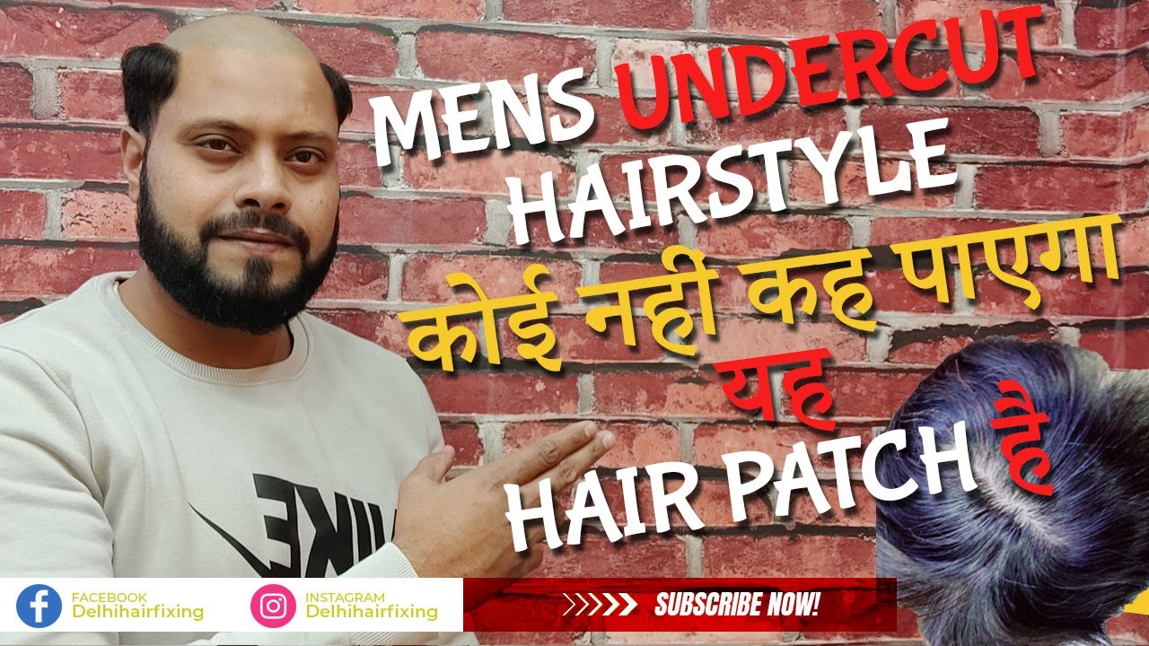 Mens Undercut Hairstyle | Best Hair Patch Style | Permanent Hair Patch