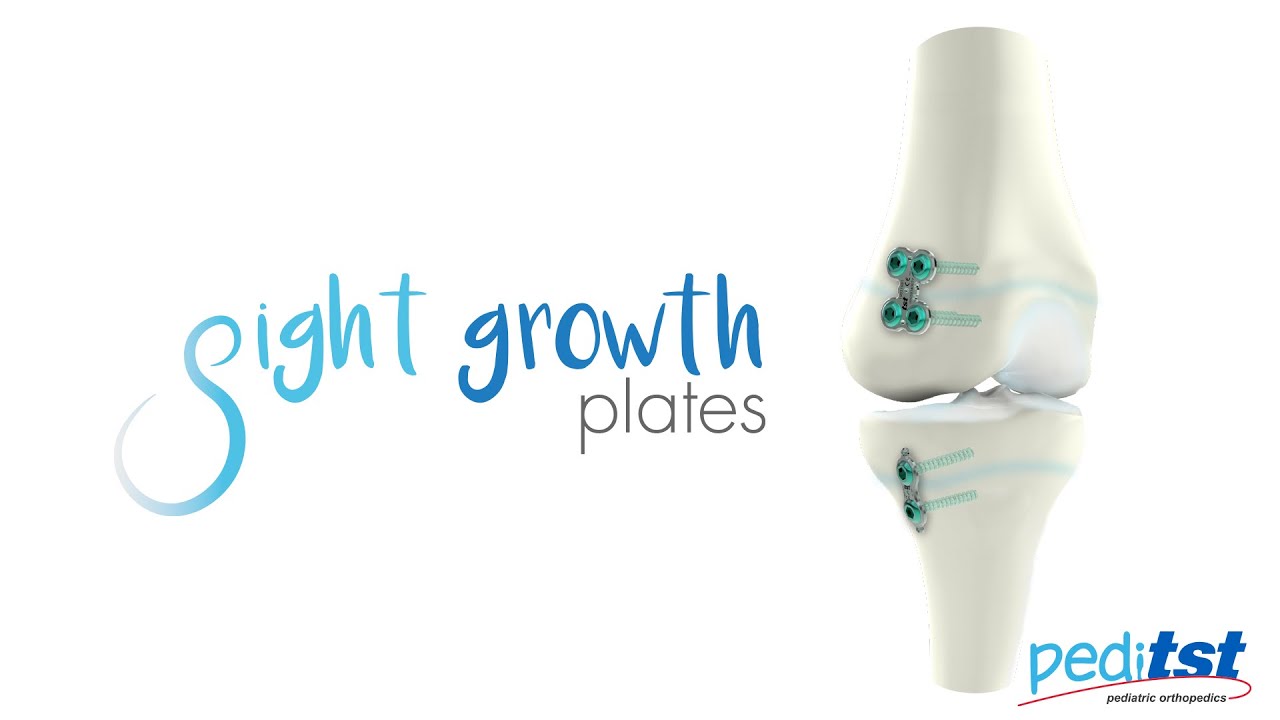 PediTST - Eight Growth Plate