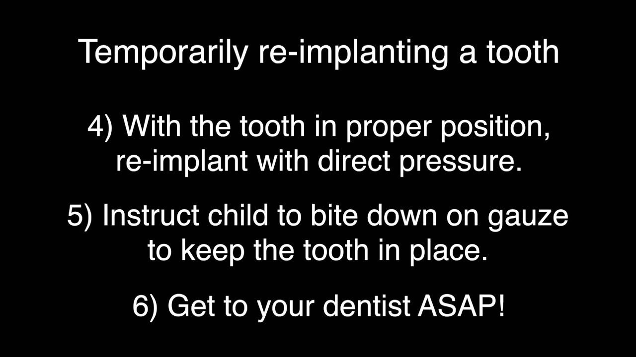 What to do when a child has a tooth knocked out