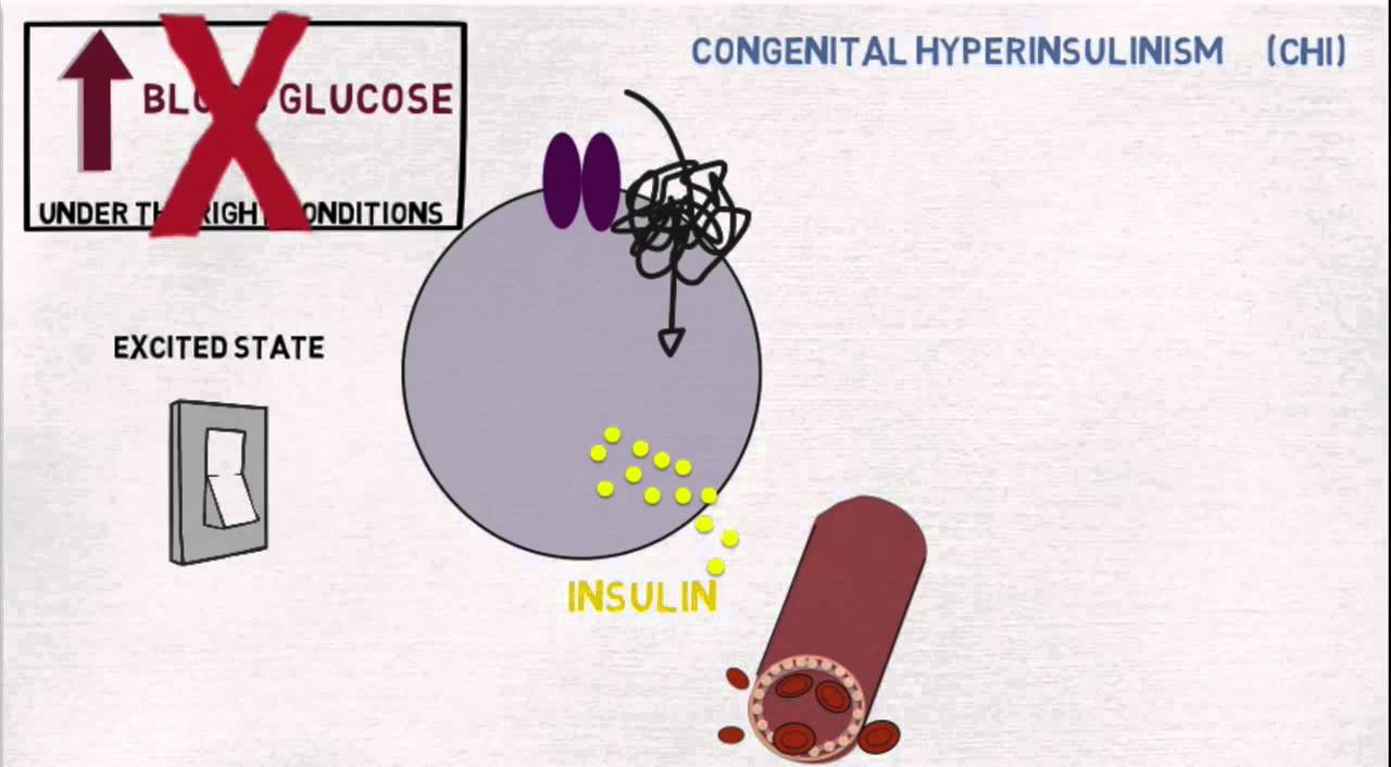 What is Congenital Hyperinsulism?