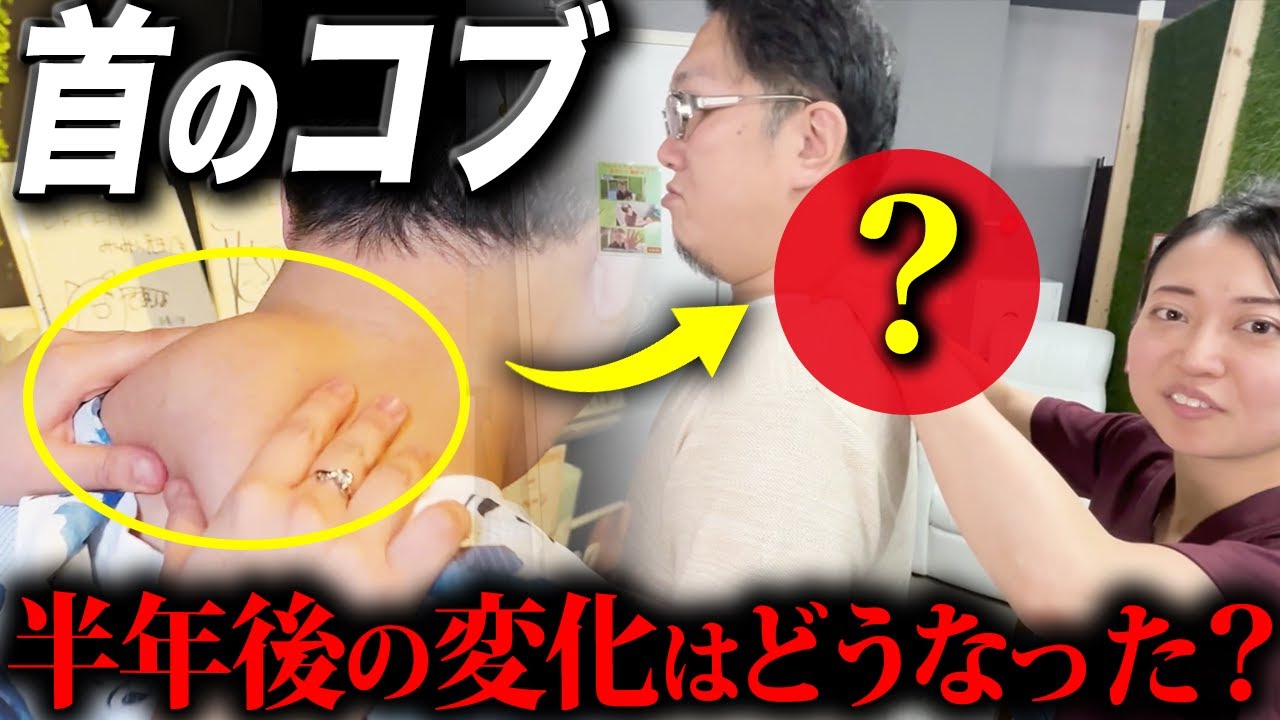 以前大きかった首のコブが…筋肉の凝り固まりを悶絶で施術していく！