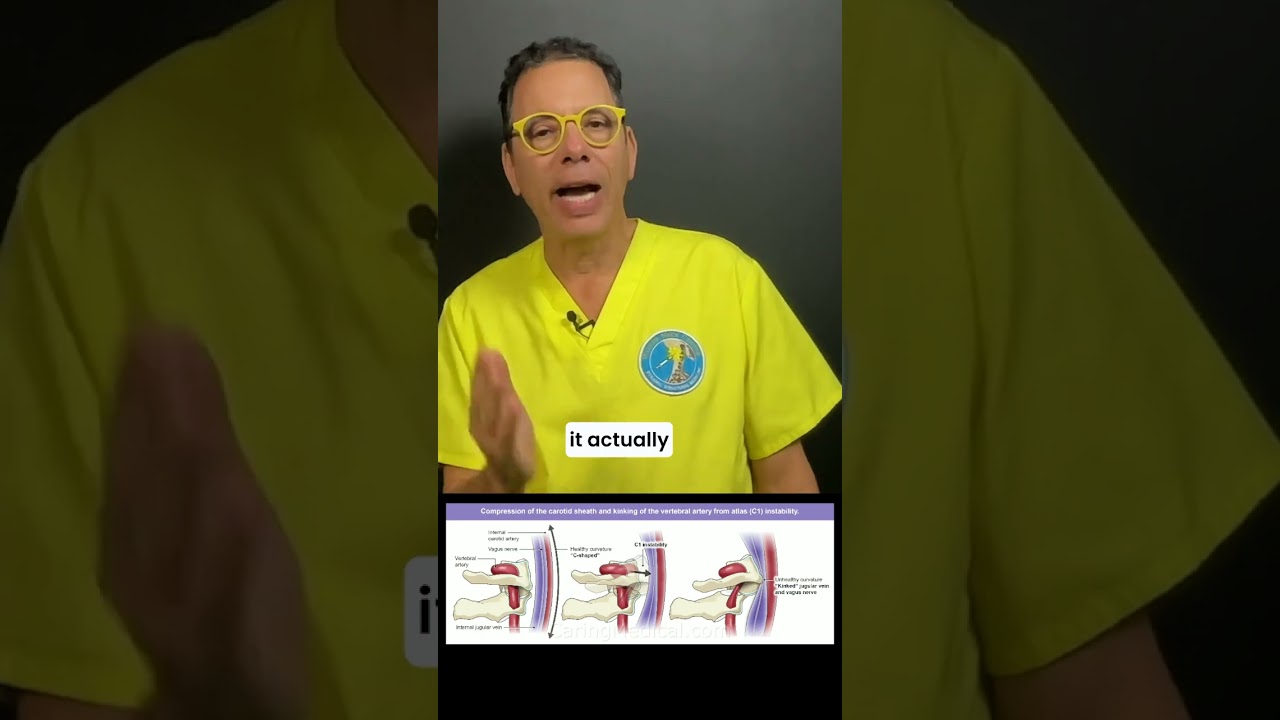 Is vertigo caused by your neck? #cervicalinstability #vertebral #artery #bloodsupply #vertigo #dizzy