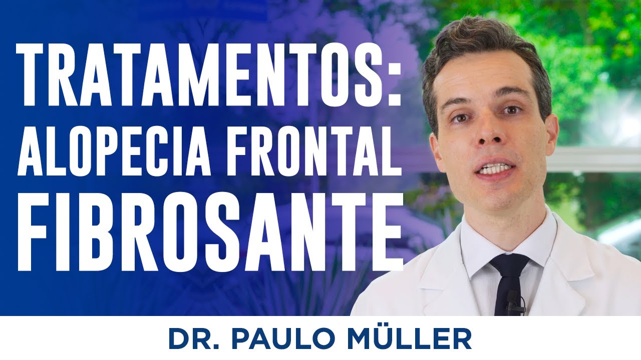 Tratamentos para Alopecia Frontal Fibrosante – Dr. Paulo Müller Dermatologista.