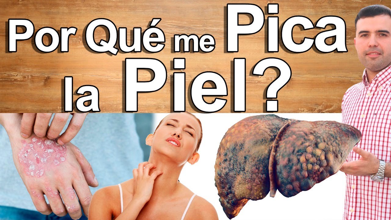 Porqu&eacute; Me Pica La Piel de Noche o de Dia - Causas y Soluciones de La Picaz&oacute;n de Piel