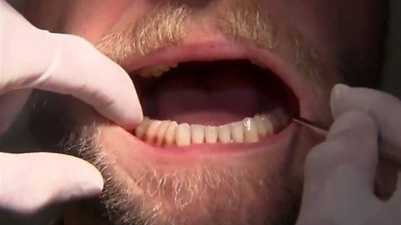 Answering embarrassing dental questions