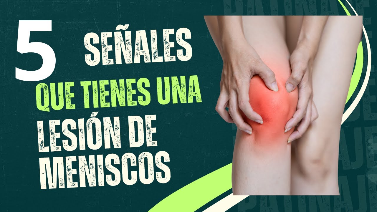 5 SE&Ntilde;ALES DE QUE TIENES UNA LESI&Oacute;N DE MENISCO ( Y SI TIENES LA &Uacute;LTIMA SEGURO EST&Aacute; ROTO)