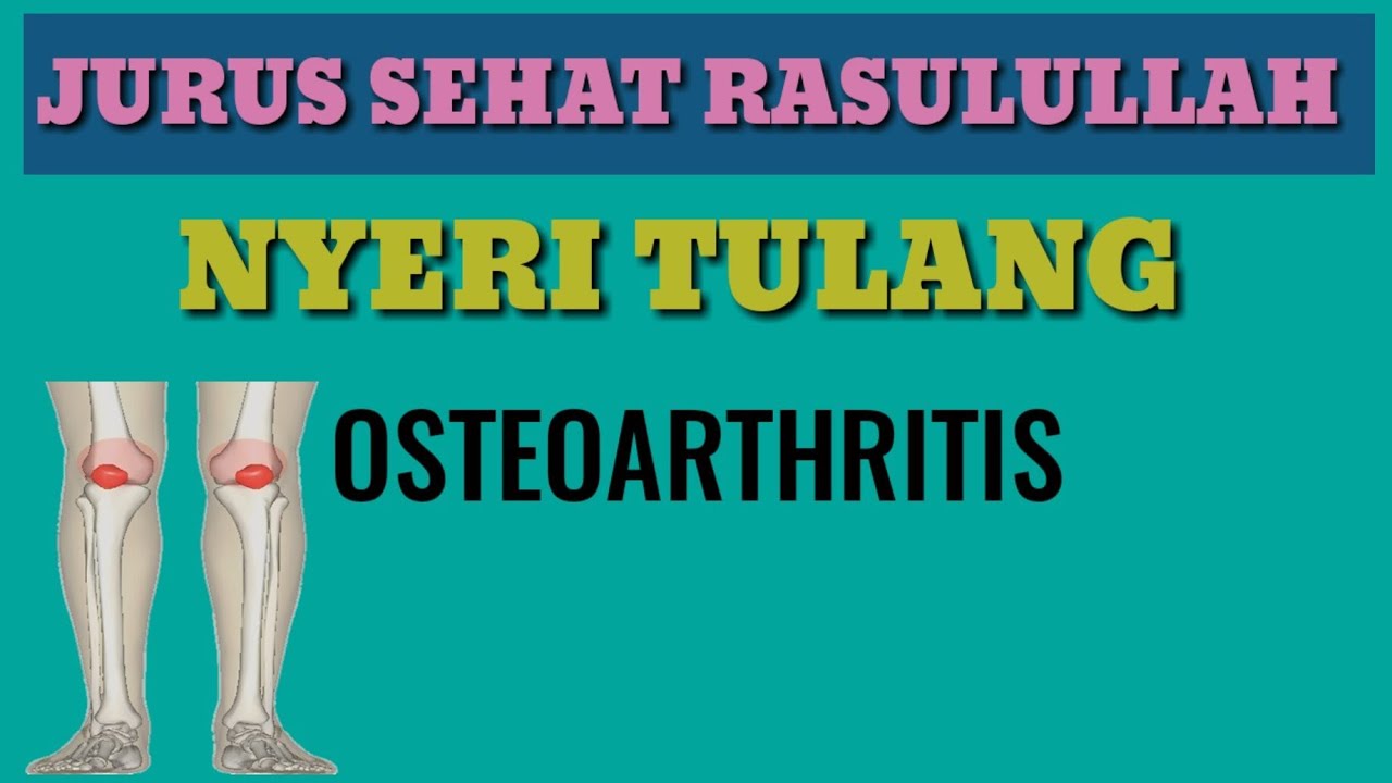 Jurus Sehat Rasulullah (JSR) Ramuan Herbal Osteoarthritis - Nyeri Tulang ( Pengapuran)