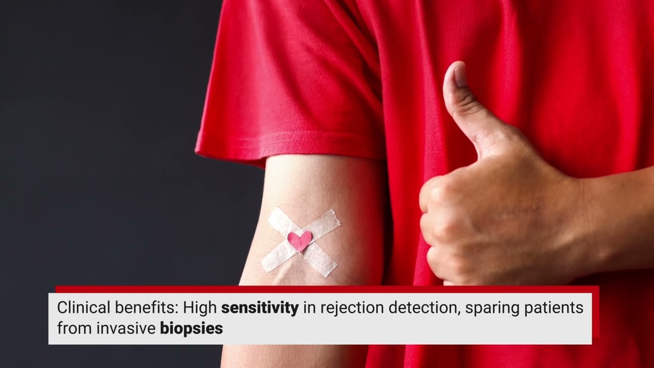 How Does Cell Free DNA Testing Aid Heart Transplant Rejection Monitoring?