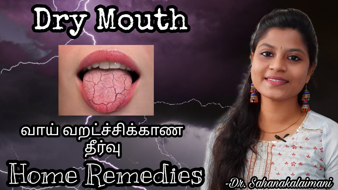 Home Remedies for DRY MOUTH. வாய் வறட்ச்சிக்காண தீர்வு..