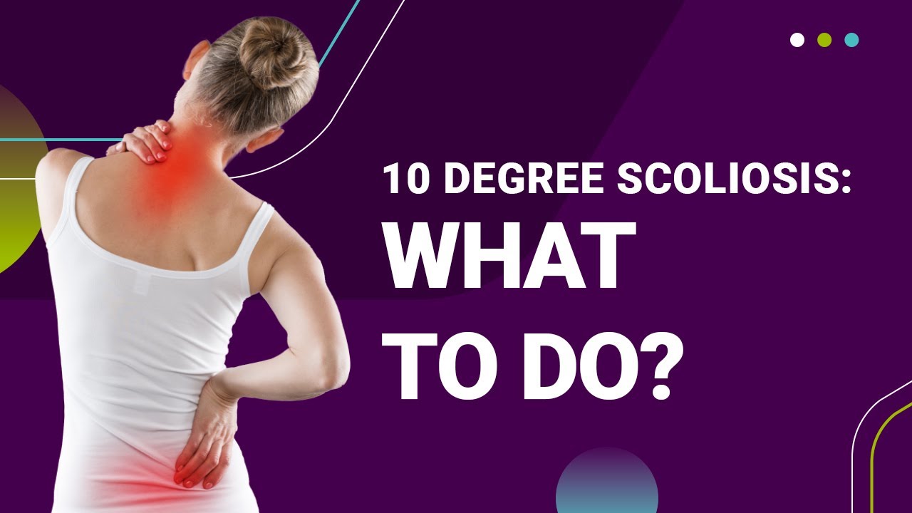 10 Degree Scoliosis: What To Do?