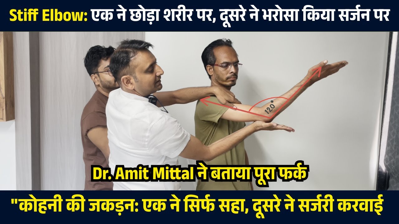 Elbow Stiffness की एक जैसी परेशानी, लेकिन इलाज अलग-  अब फर्क देखिए!  Elbow Stiffness treat