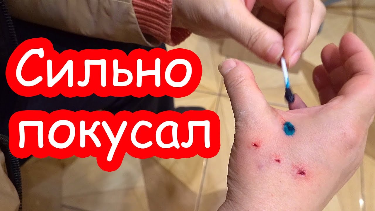 VLOG Сильно покусал