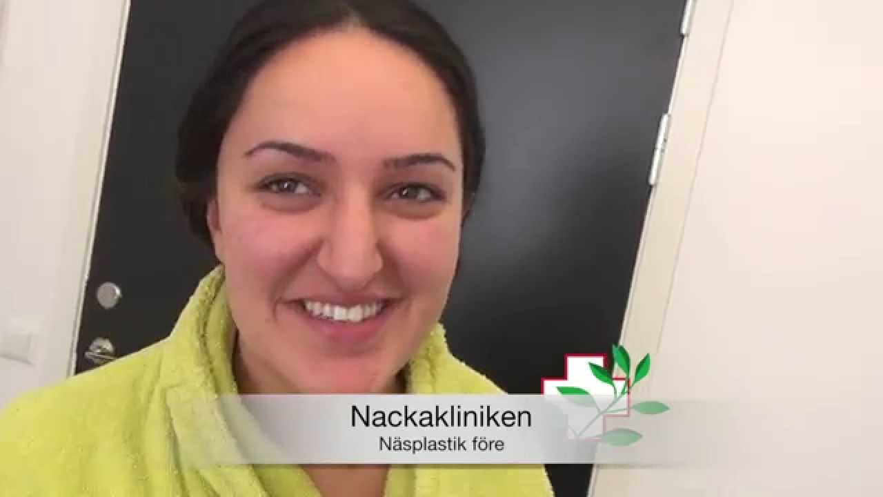 N&auml;splastik f&ouml;re operation. Primakliniken Plastikoperationer