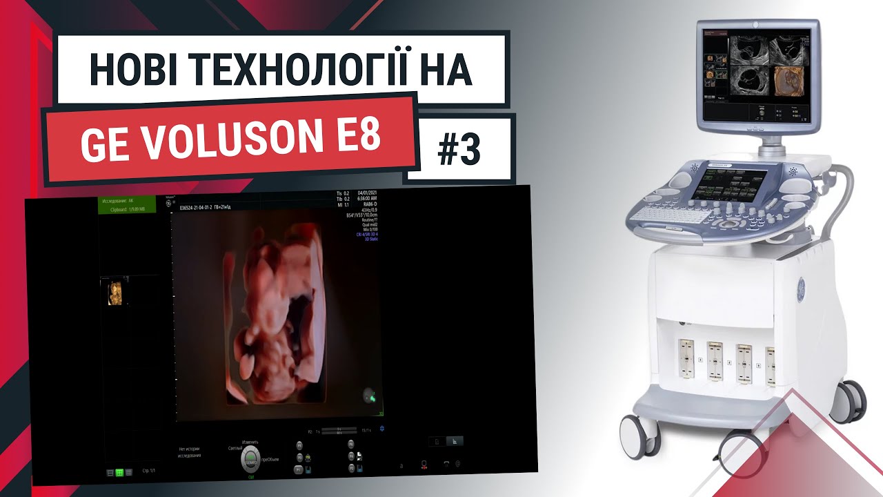 Функція HD Live Studio на УЗД апараті GE Voluson E8