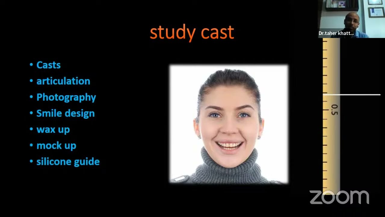 Smile & Veneers Concerns معايير الابتسامة والفنيرات Dr Taher Khattab