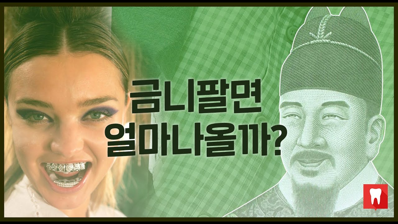 금이빨 | 금니 팔면 얼마 나올까??