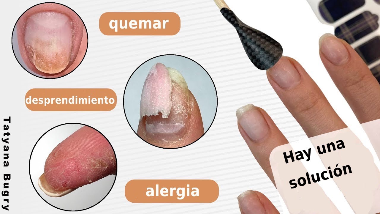 Desprendimiento de uñas? Alergia? Quemar? 🛑 Hay una solución ☝ #TatianaMaestradeUñas