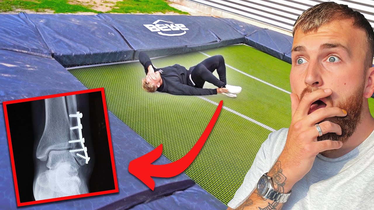 PIJNLIJK ONGELUK OP GROOTSTE TRAMPOLINE TER WERELD!