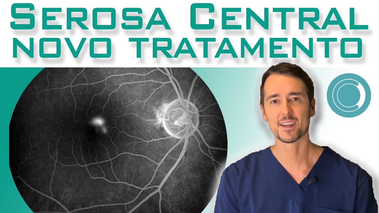 Serosa central - novo tratamento !!!?