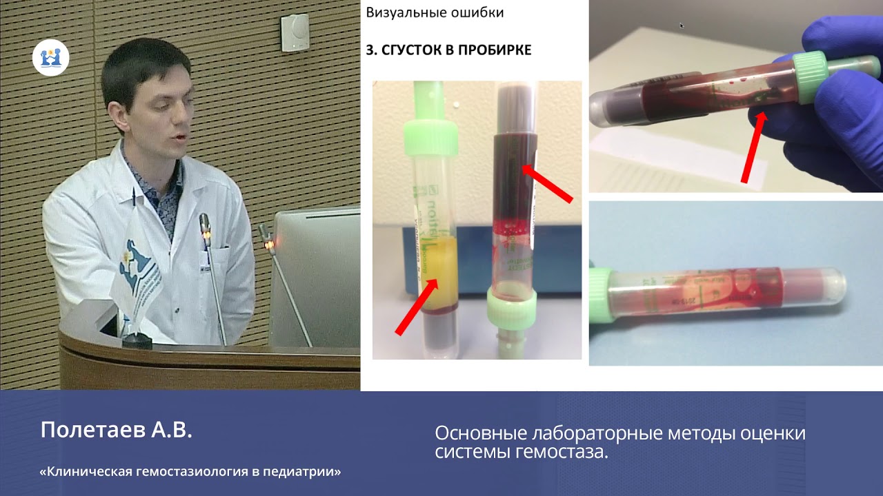Основные лабораторные методы оценки системы гемостаза